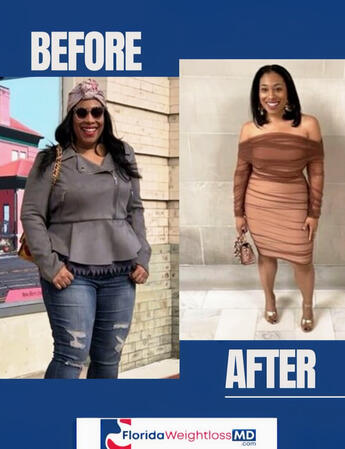 Before And After Medical Weight Loss Results