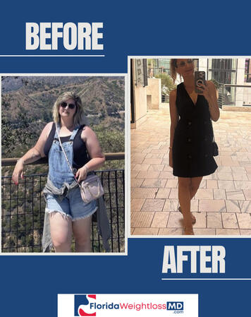 Before And After Weight Loss Results